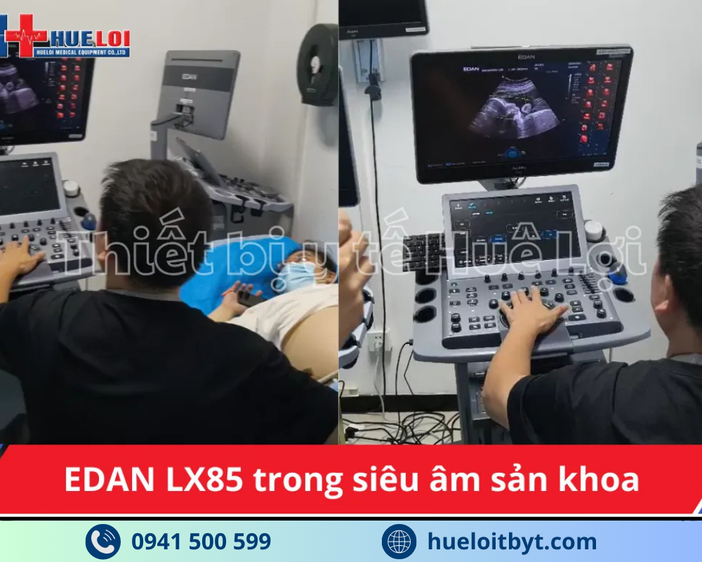 MÁY SIÊU ÂM CHẨN ĐOÁN CAO CẤP EDAN ACCLARIX LX85