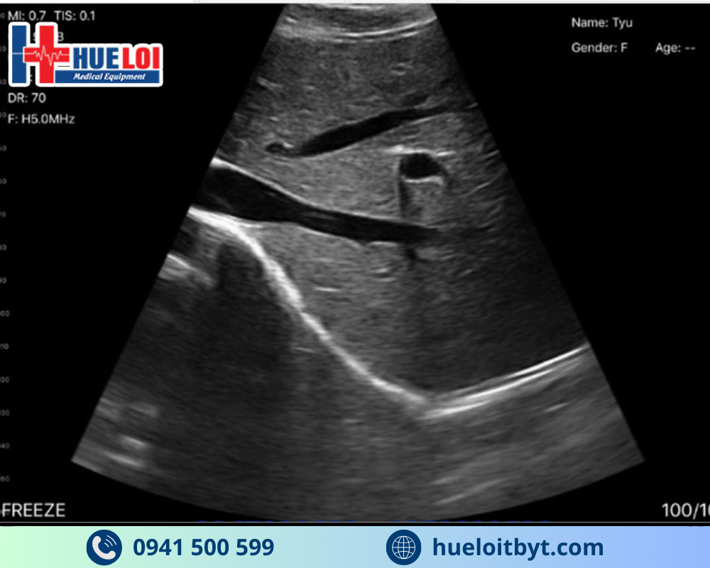 MÁY SIÊU ÂM CẦM TAY KHÔNG DÂY 3 ĐẦU DÒ