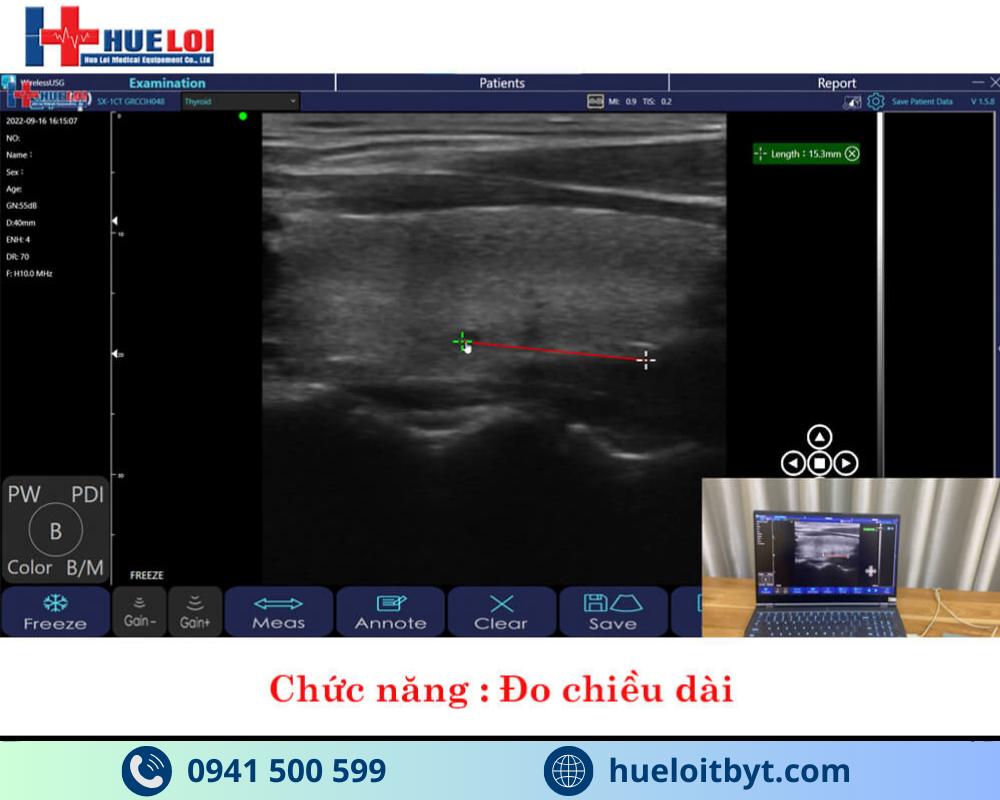 MÁY SIÊU ÂM CẦM TAY KHÔNG DÂY 3 ĐẦU DÒ