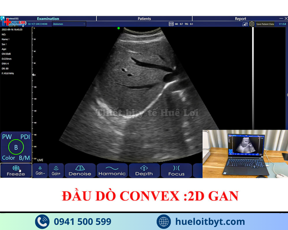 MÁY SIÊU ÂM CẦM TAY KHÔNG DÂY 3 ĐẦU DÒ