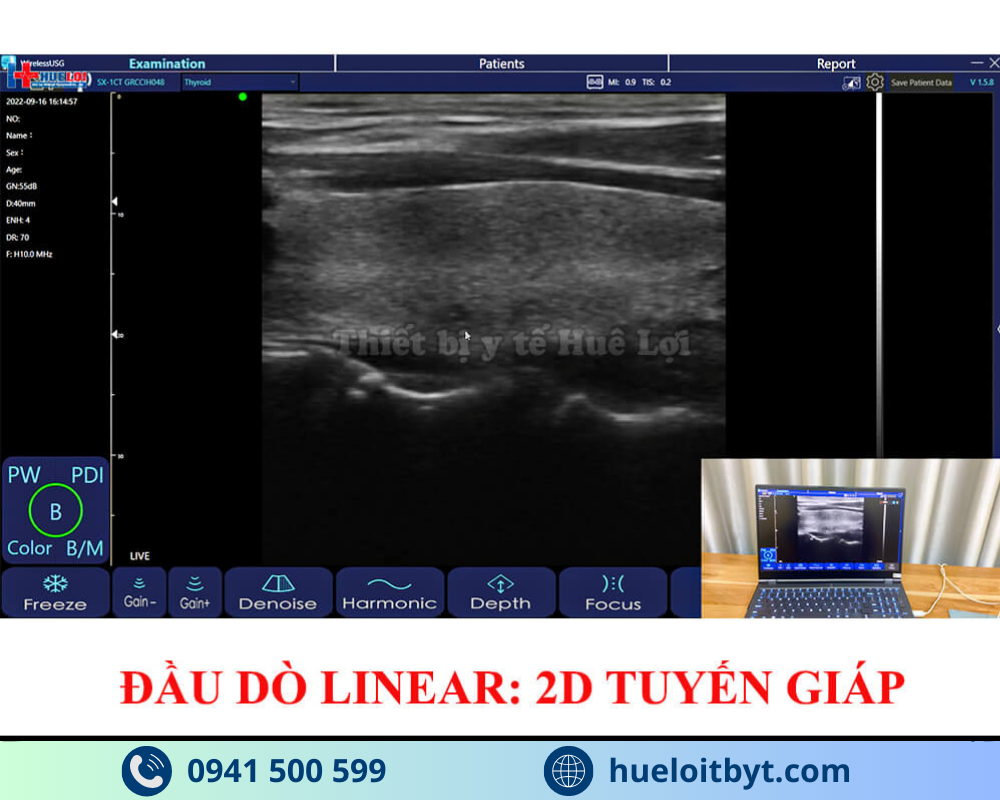 MÁY SIÊU ÂM CẦM TAY KHÔNG DÂY 3 ĐẦU DÒ