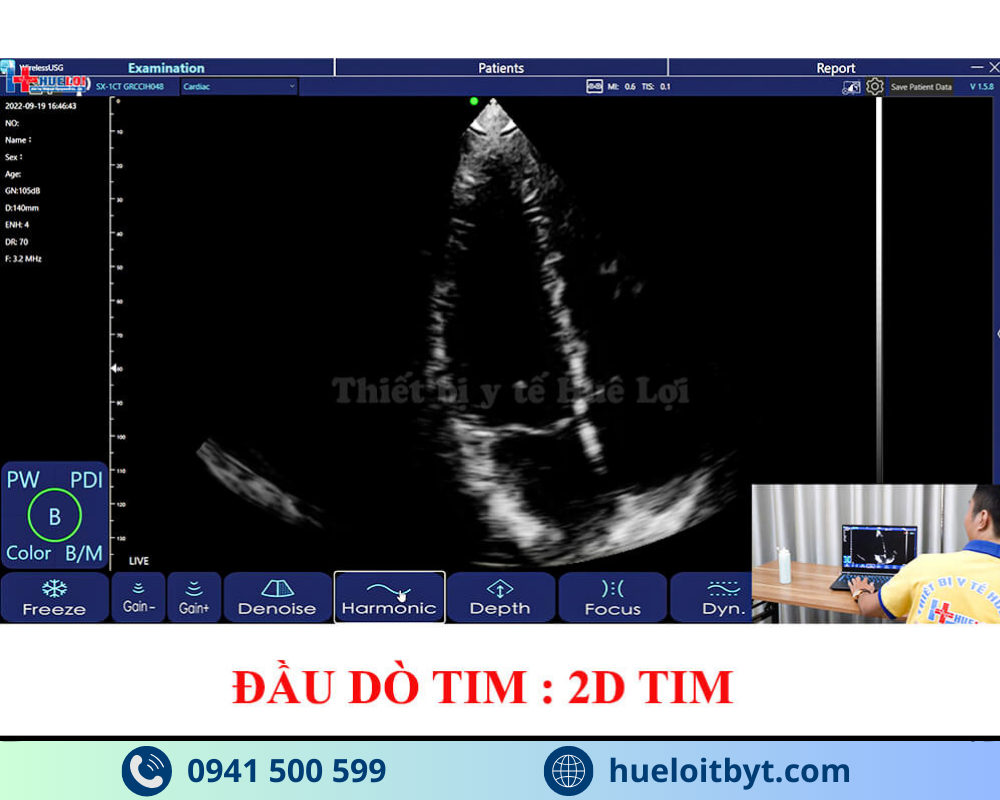 MÁY SIÊU ÂM CẦM TAY KHÔNG DÂY 3 ĐẦU DÒ