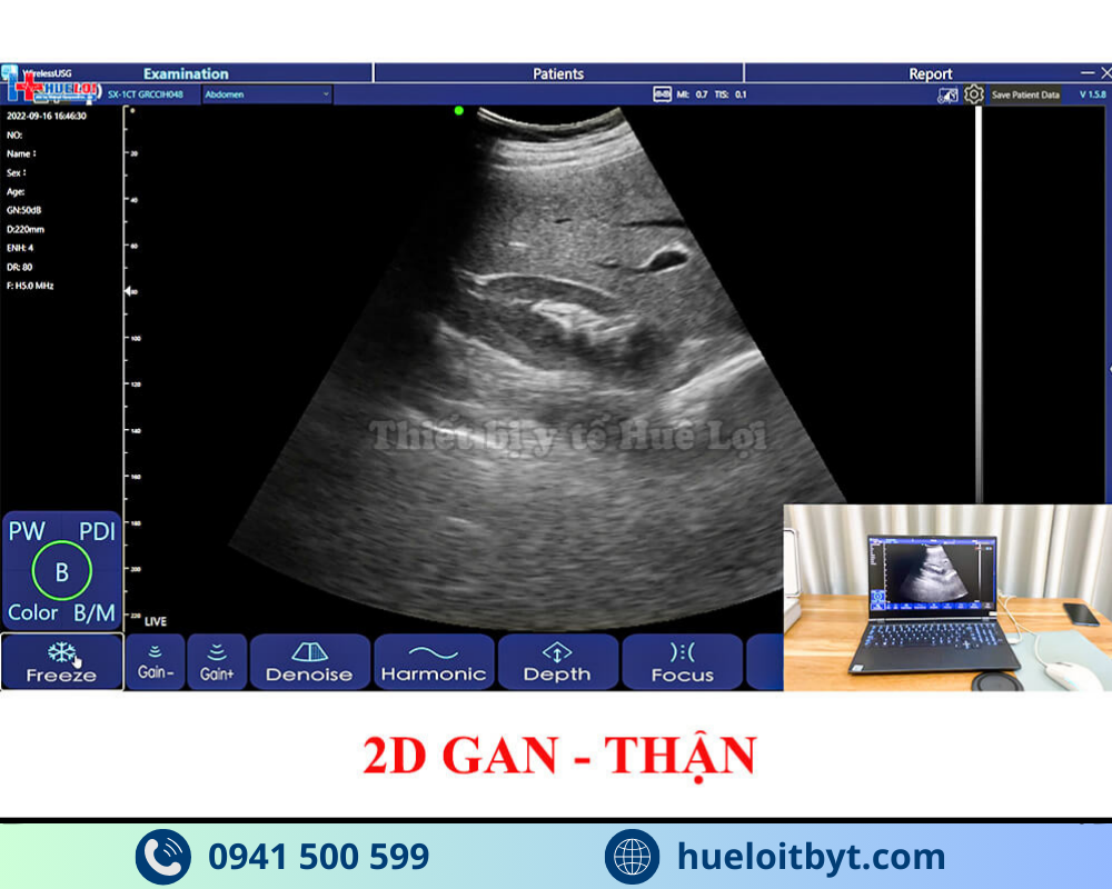 MÁY SIÊU ÂM CẦM TAY KHÔNG DÂY 3 ĐẦU DÒ