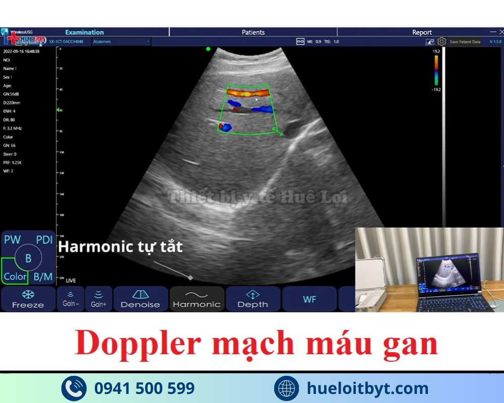 MÁY SIÊU ÂM CẦM TAY KHÔNG DÂY 3 ĐẦU DÒ