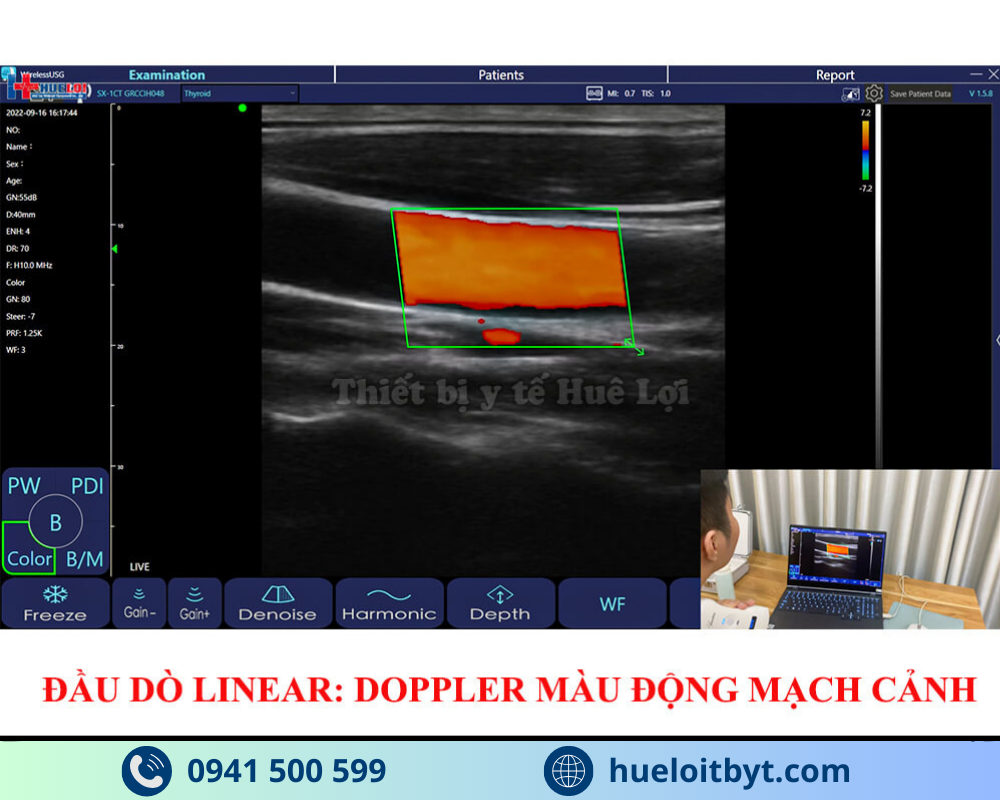 MÁY SIÊU ÂM CẦM TAY KHÔNG DÂY 3 ĐẦU DÒ