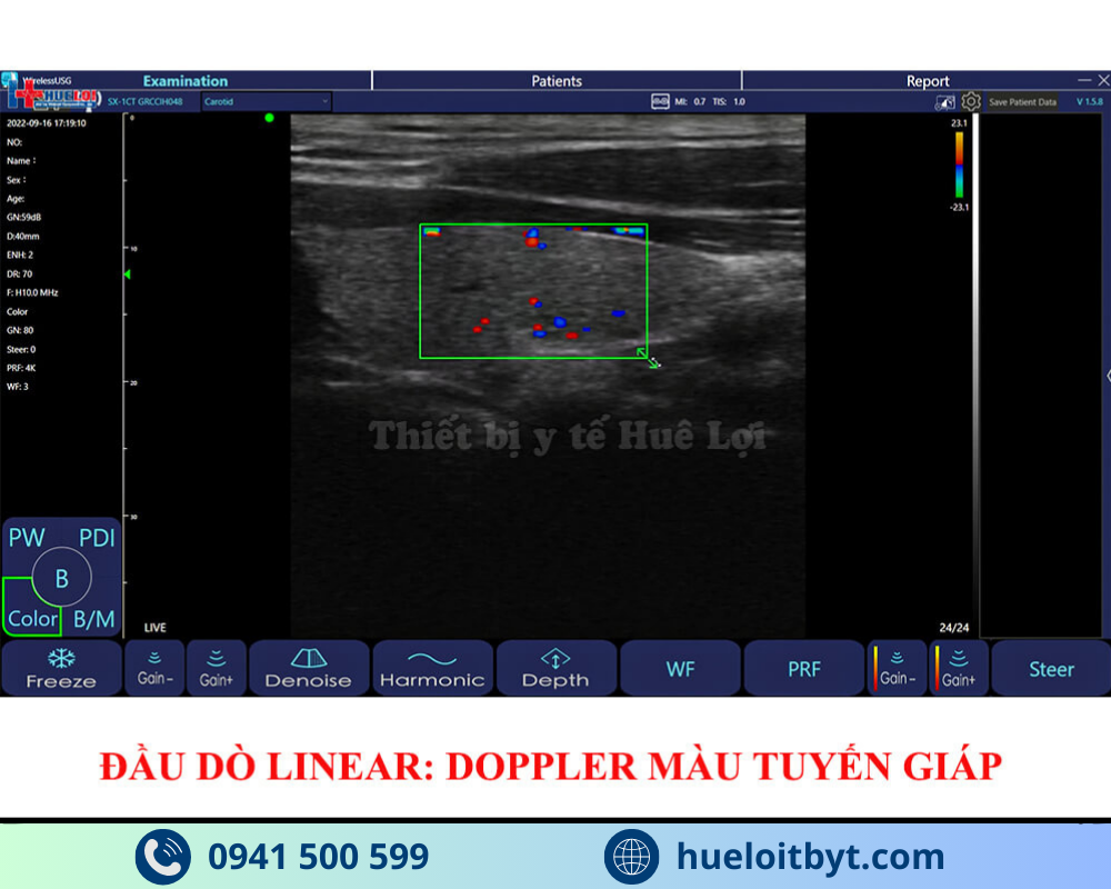 MÁY SIÊU ÂM CẦM TAY KHÔNG DÂY 3 ĐẦU DÒ