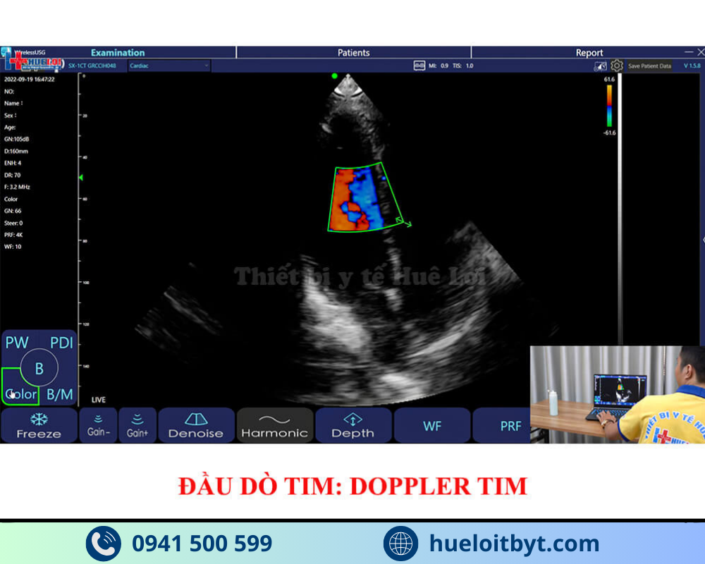 MÁY SIÊU ÂM CẦM TAY KHÔNG DÂY 3 ĐẦU DÒ