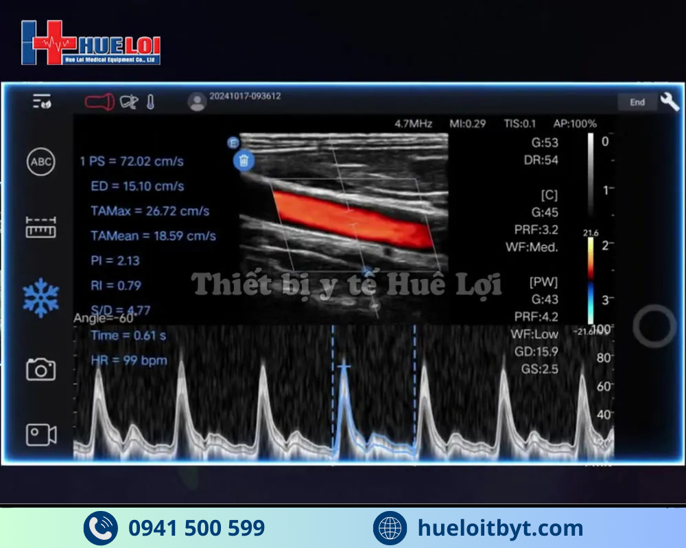 MÁY SIÊU ÂM CẦM TAY EDAN NANO C5 EXP HIỆN ĐẠI