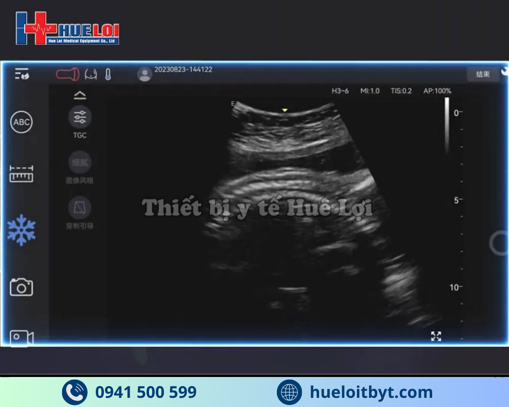 MÁY SIÊU ÂM CẦM TAY EDAN NANO C5 EXP HIỆN ĐẠI