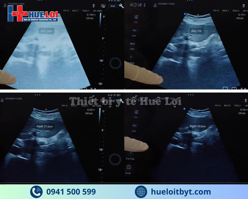 MÁY SIÊU ÂM CẦM TAY EDAN NANO C5 EXP HIỆN ĐẠI