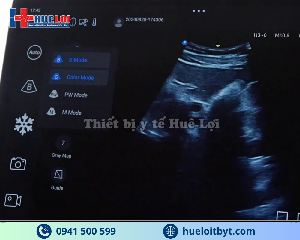 MÁY SIÊU ÂM CẦM TAY EDAN NANO L12 EXP VỚI CÁC CÔNG NGHỆ HIỆN ĐẠI