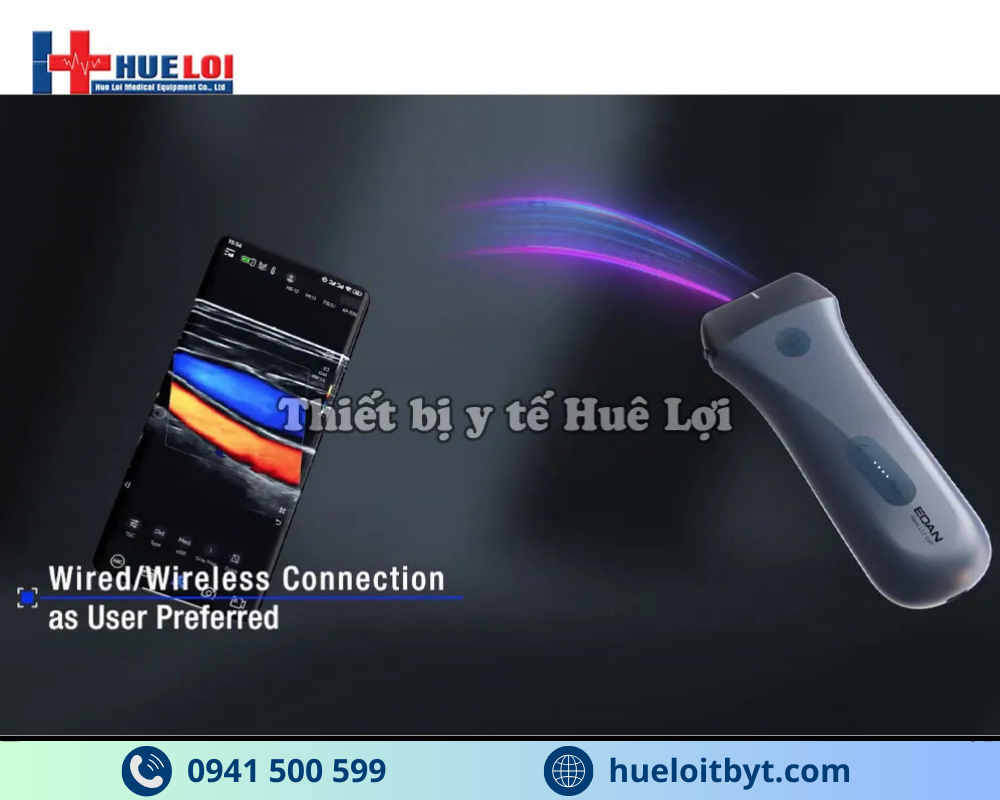 MÁY SIÊU ÂM CẦM TAY EDAN NANO L12 EXP VỚI CÁC CÔNG NGHỆ HIỆN ĐẠI