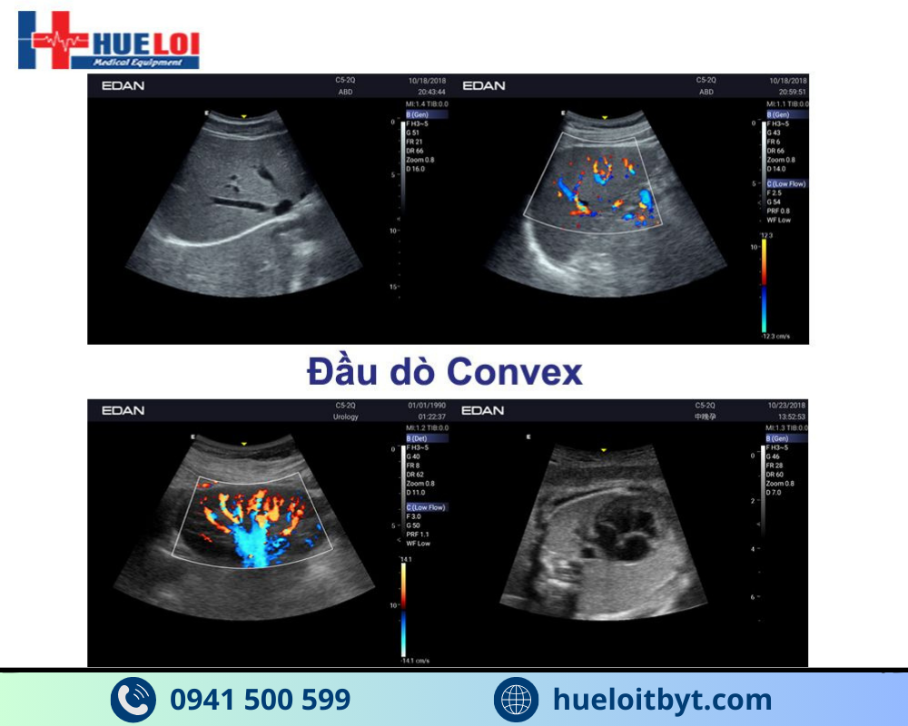 MÁY SIÊU ÂM HÌNH ẢNH EDAN AX3 CAO CẤP