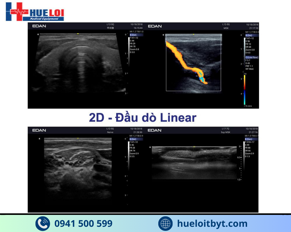 MÁY SIÊU ÂM HÌNH ẢNH EDAN AX3 CAO CẤP