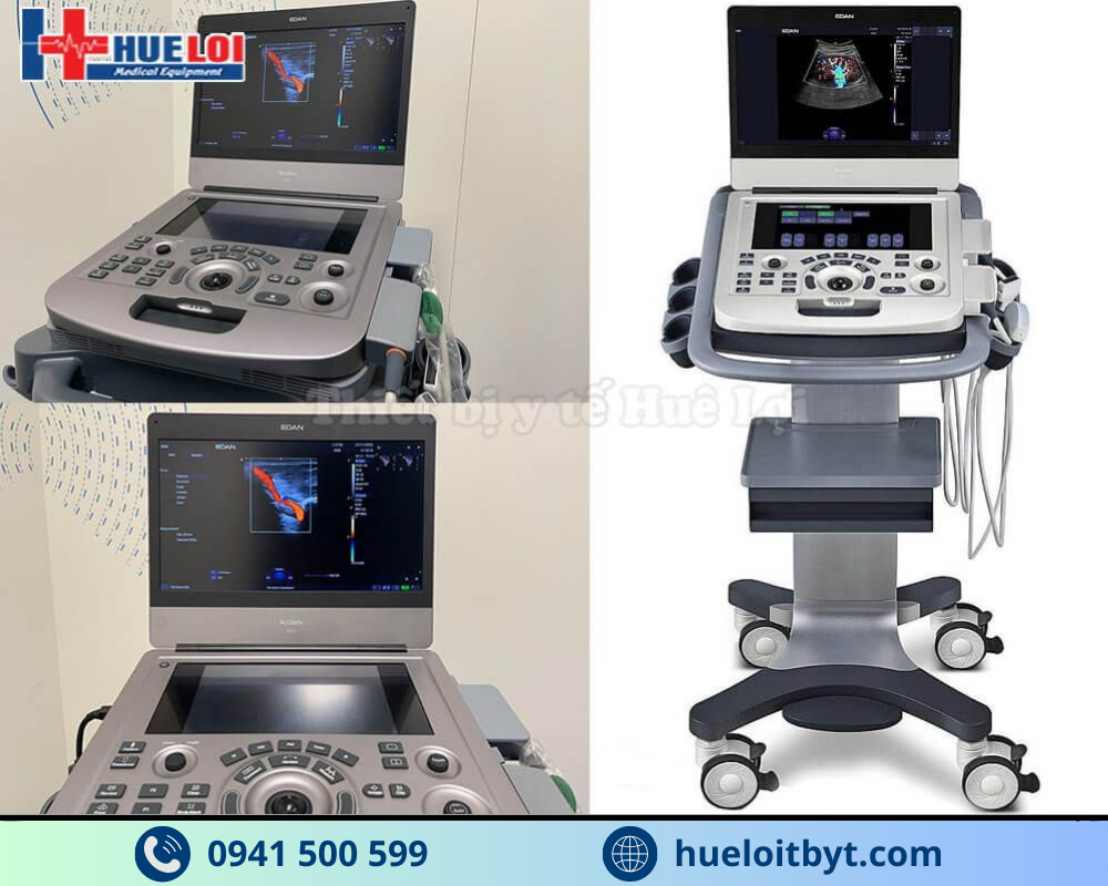 MÁY SIÊU ÂM HÌNH ẢNH EDAN AX3 CAO CẤP