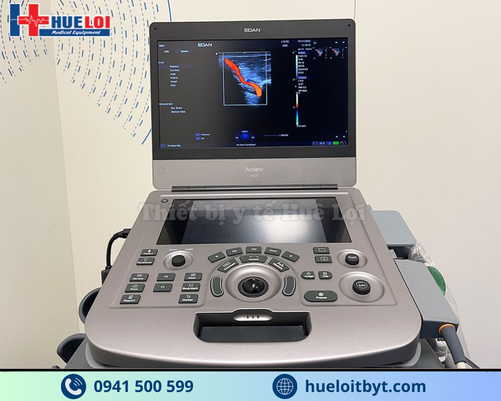 MÁY SIÊU ÂM HÌNH ẢNH EDAN AX3 CAO CẤP