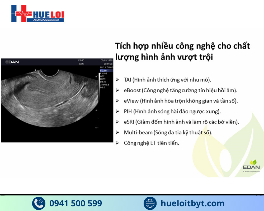 MÁY SIÊU ÂM HÌNH ẢNH EDAN AX3 CAO CẤP