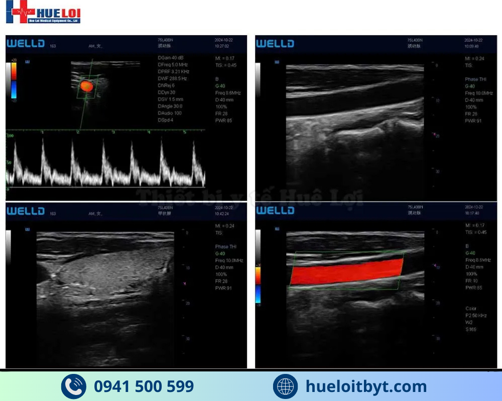 MÁY SIÊU ÂM XÁCH TAY CẢM ỨNG 2 ĐẦU DÒ P10