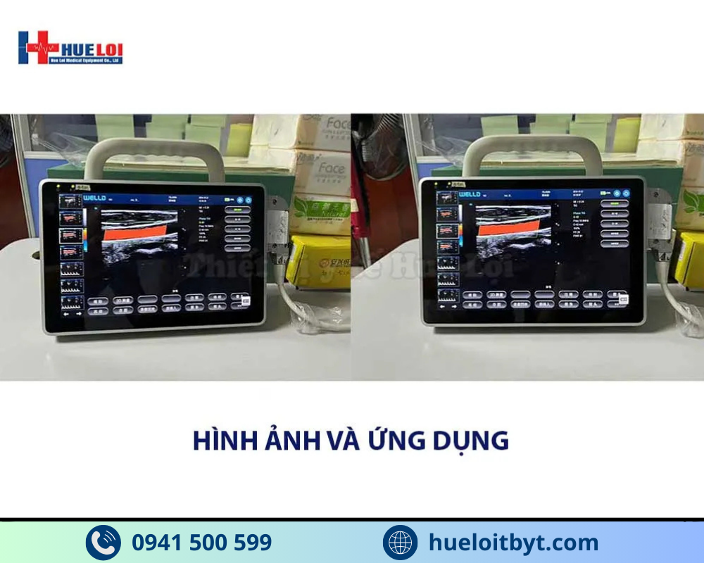 MÁY SIÊU ÂM XÁCH TAY CẢM ỨNG 2 ĐẦU DÒ P10