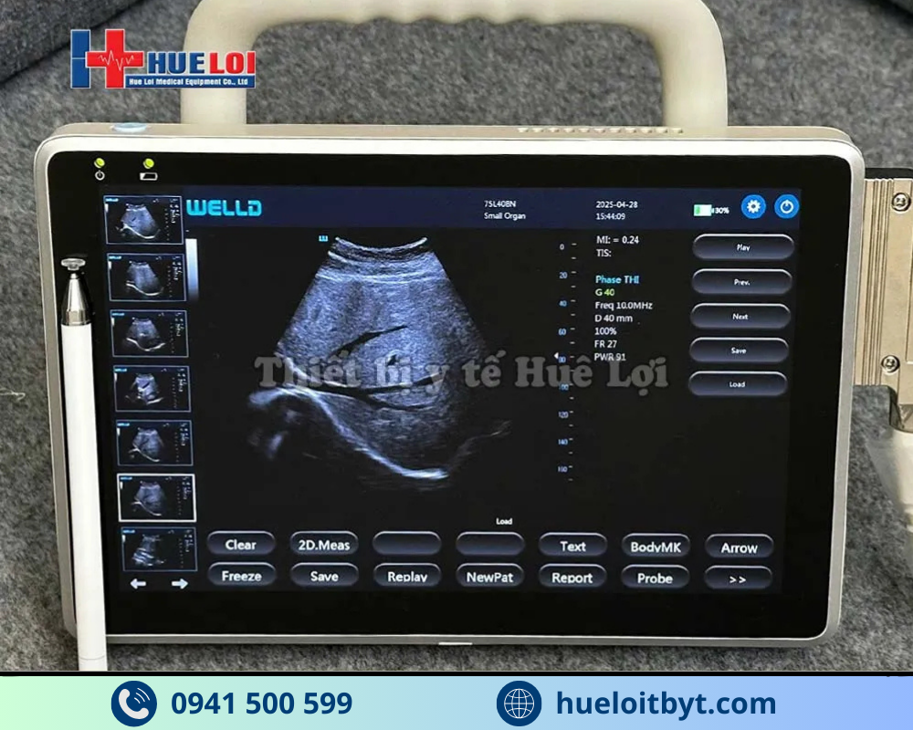 MÁY SIÊU ÂM XÁCH TAY CẢM ỨNG 2 ĐẦU DÒ P10