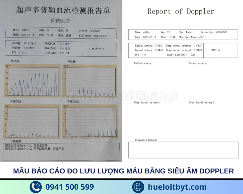 bảng kết quả của máy đo rối loạn tình dục nam giới