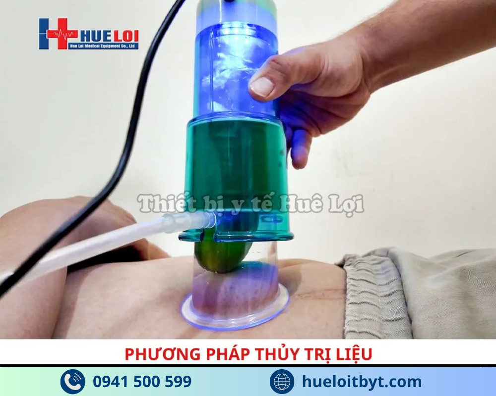 phương pháp thủy trị liệu của máy điều trị rối loạn cương dương