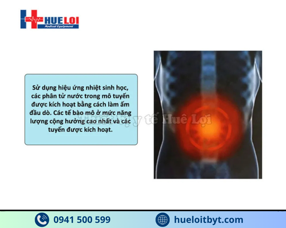 phương pháp nhiệt trị liệu điều trị bệnh tuyến tiền liệt