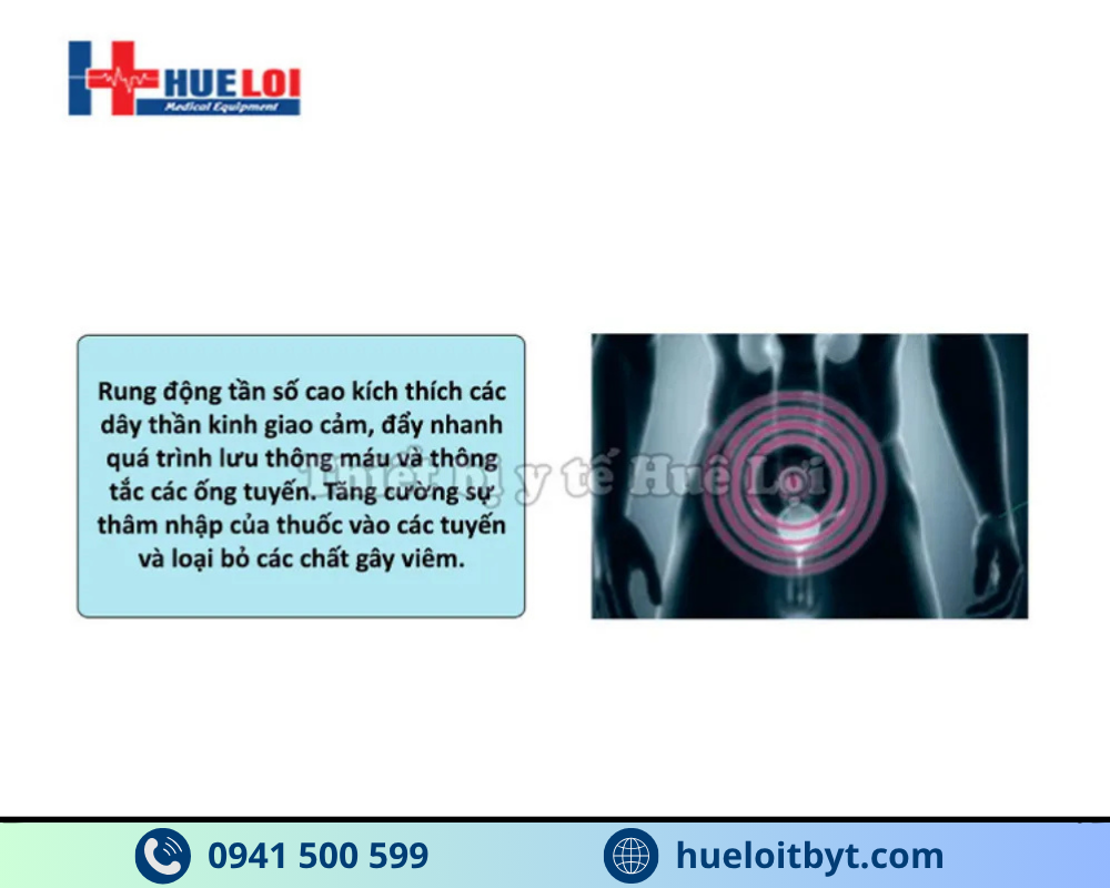 Phương pháp từ trường trị liệu điều trị bệnh tuyến tiền liệt