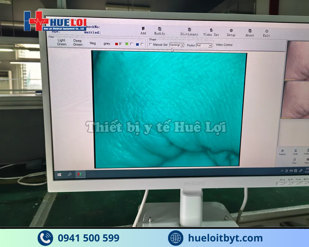 MÁY SOI CỔ TỬ CUNG GIÁ RẺ SW-302