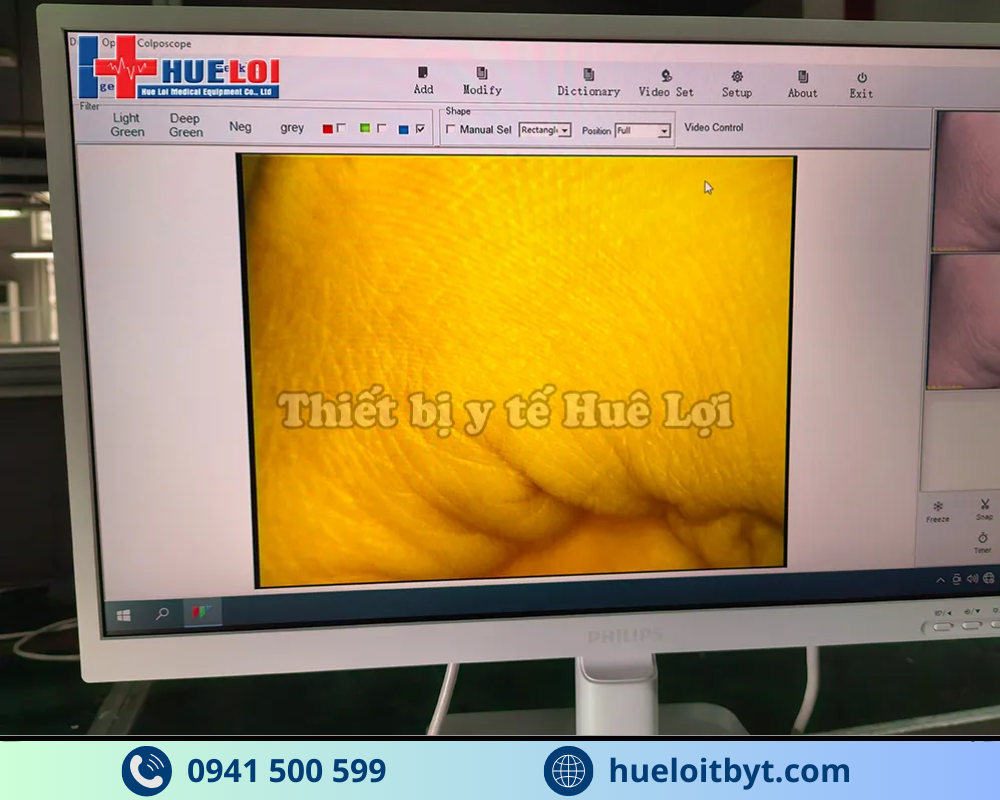 MÁY SOI CỔ TỬ CUNG GIÁ RẺ SW-302