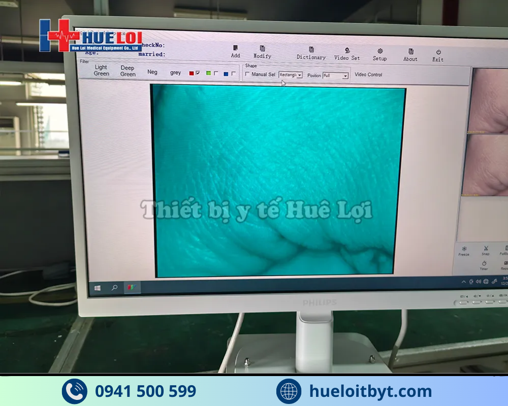 MÁY SOI CỔ TỬ CUNG FULL HD SW-304 GIÁ RẺ