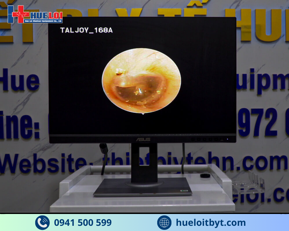 MÁY NỘI SOI TAI MŨI HỌNG SD TJ-168A GIÁ RẺ