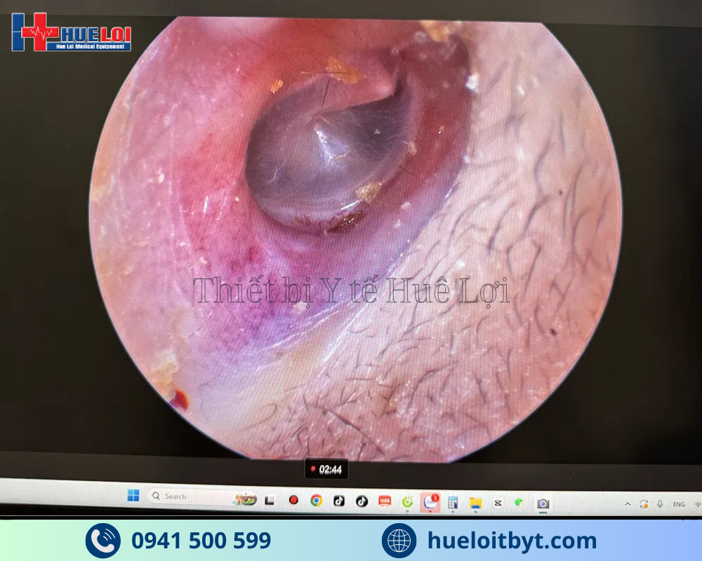 MÁY NỘI SOI TAI MŨI HỌNG MINI FULL HD GIÁ RẺ