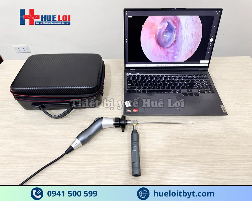 MÁY NỘI SOI TAI MŨI HỌNG MINI FULL HD GIÁ RẺ