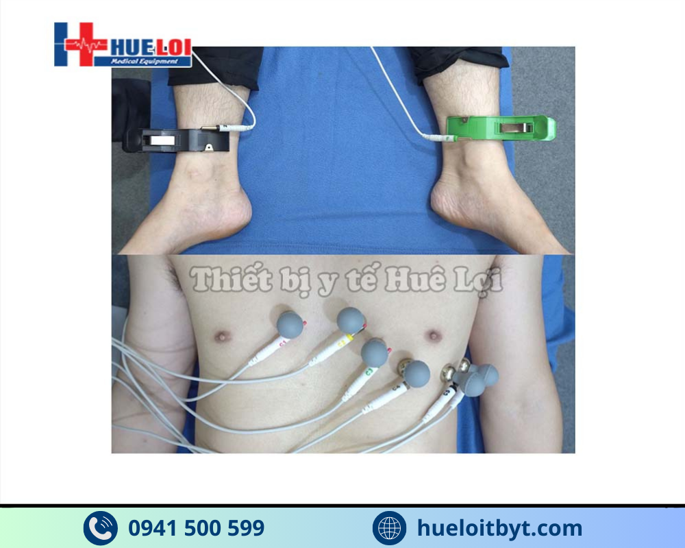 MÁY ĐO ĐIỆN TIM 3 KÊNH ECG300G
