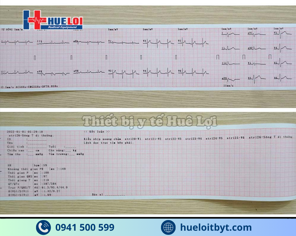 MÁY ĐO ĐIỆN TIM 3 KÊNH ECG300G