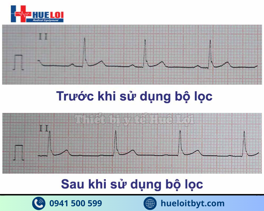 MÁY ĐIỆN TIM 6 KÊNH ECG600G