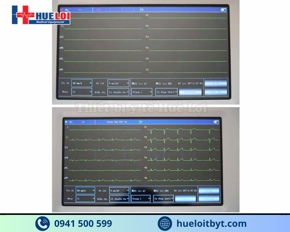 MÁY ĐIỆN TIM 6 KÊNH ECG600G