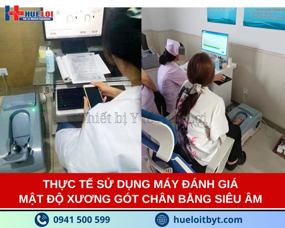 Hình ảnh thực tế sử dụng máy đo mật độ xương gót chân bằng sóng siêu âm osteokj3000m