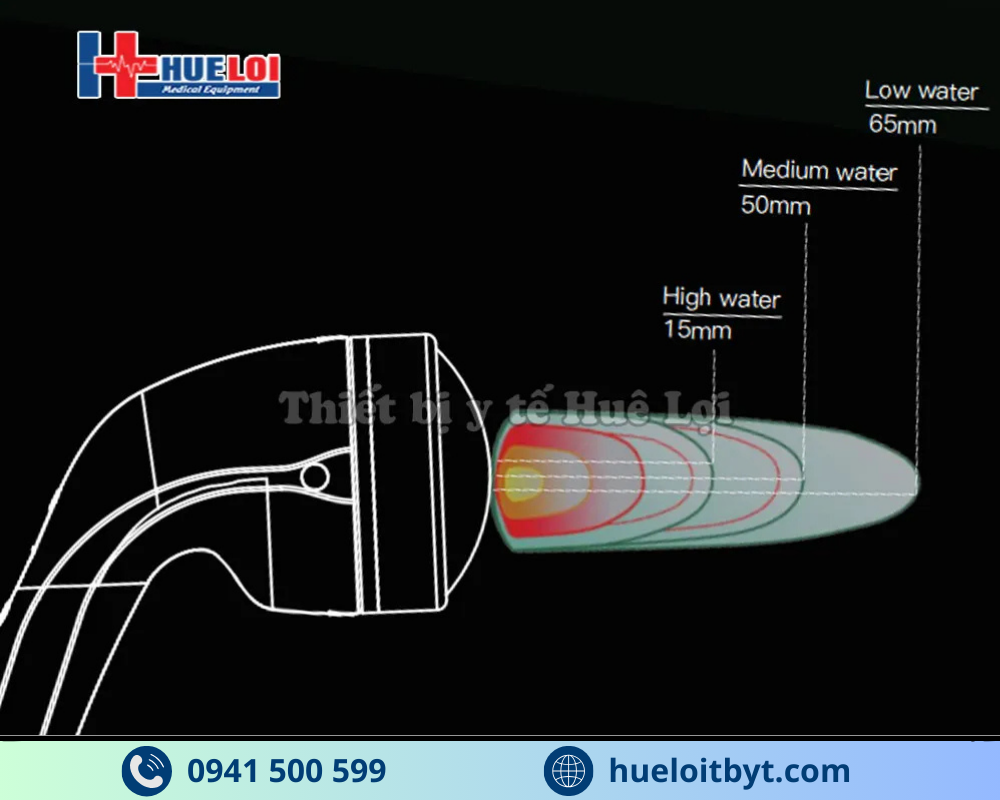 MÁY XUNG KÍCH HỘI TỤ CAO CẤP EMFOCUS-I