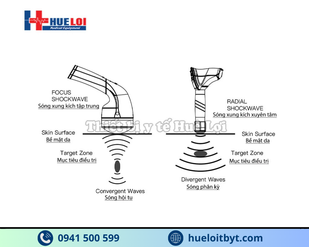 MÁY XUNG KÍCH HỘI TỤ CAO CẤP EMFOCUS-I
