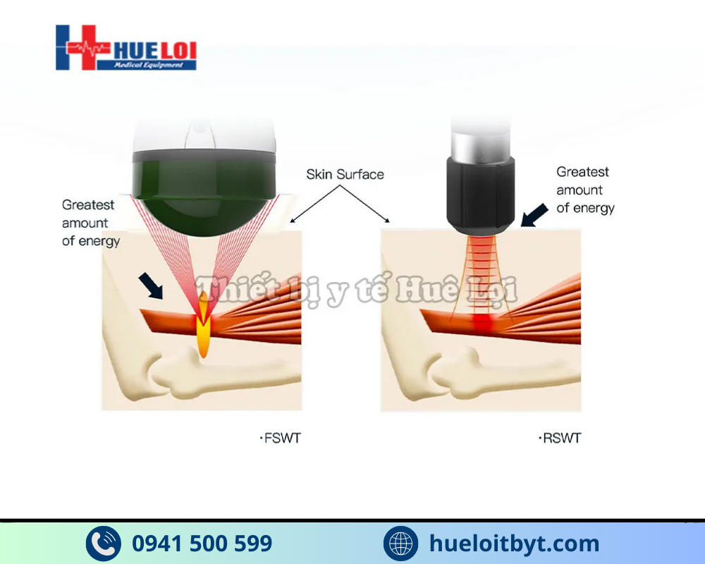 MÁY XUNG KÍCH HỘI TỤ CAO CẤP EMFOCUS-I