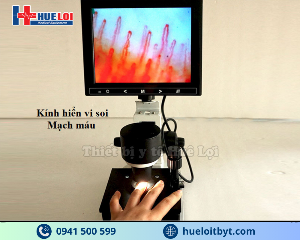 KÍNH HIỂN VI SOI MẠCH MÁU GIÁ RẺ