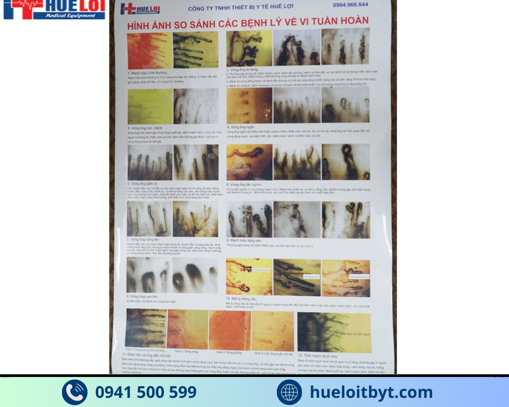 KÍNH HIỂN VI SOI MẠCH MÁU GIÁ RẺ