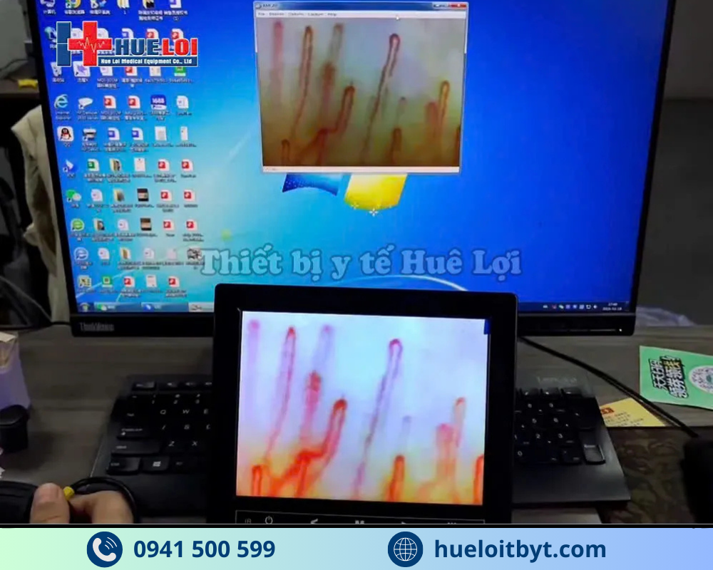 KÍNH HIỂN VI SOI MẠCH MÁU ĐỘ PHÓNG ĐẠI CAO