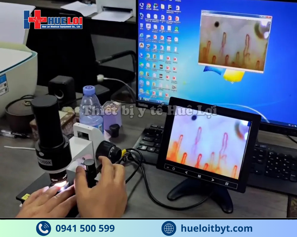 KÍNH HIỂN VI SOI MẠCH MÁU ĐỘ PHÓNG ĐẠI CAO