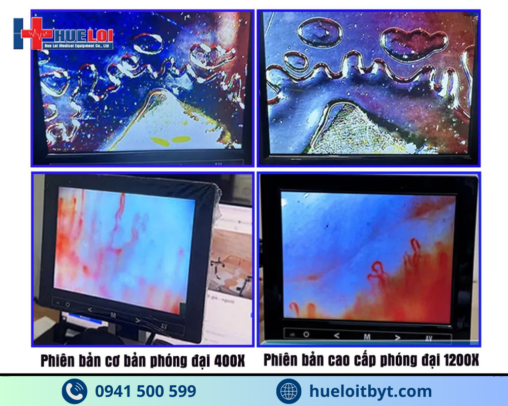 KÍNH HIỂN VI SOI MẠCH MÁU ĐỘ PHÓNG ĐẠI CAO