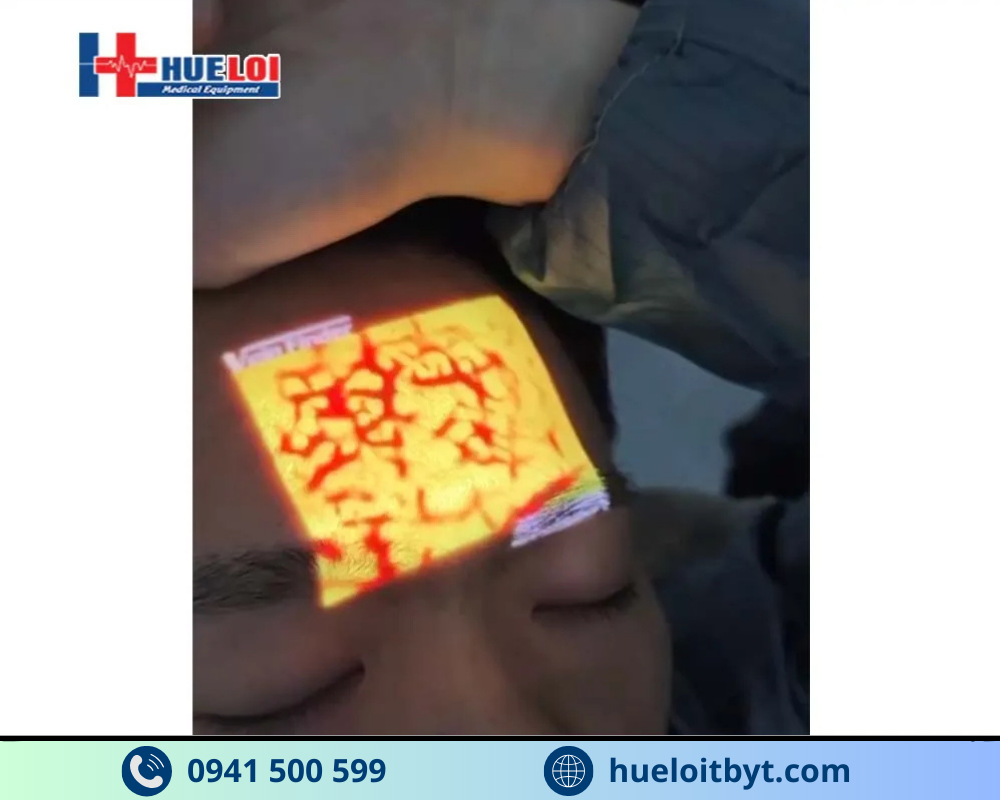 MÁY SOI VEIN CẦM TAY GIÁ RẺ QV-600