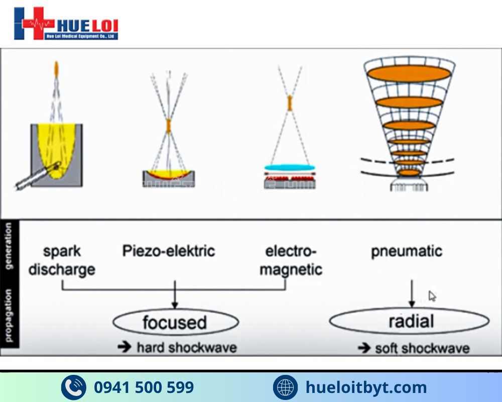 nguyên lý hoạt động của sóng xung kích