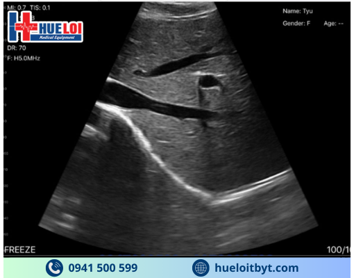 MÁY SIÊU ÂM CẦM TAY KHÔNG DÂY 3 ĐẦU DÒ